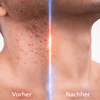 Bump Stopper Sensitive Skin 14g - CosFair GmbH