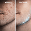 Bump Patrol Aftershave Treatment - Sensitive - CosFair GmbH