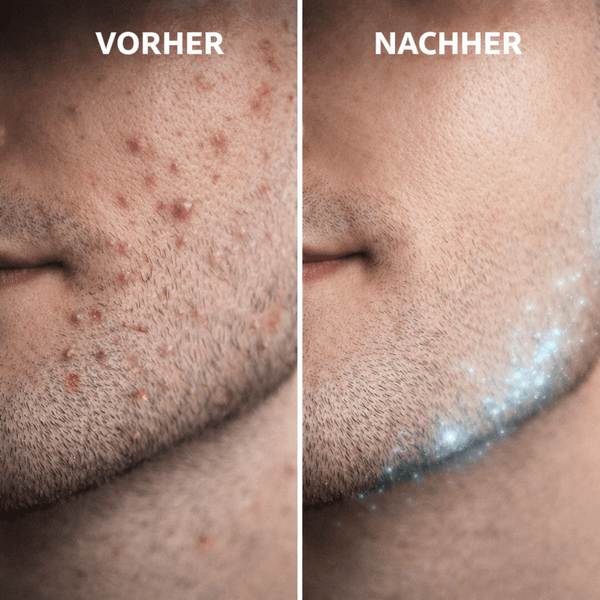 Bump Patrol Aftershave Treatment - Sensitive - CosFair GmbH
