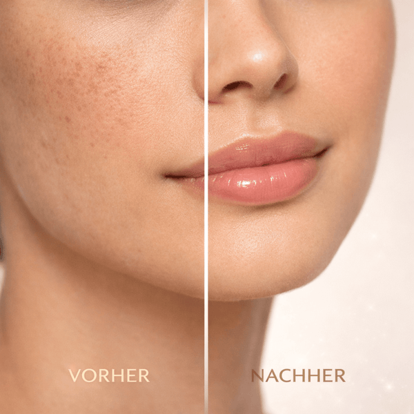 HT26 Action Taches Carrot Oil Lotion 500ml - CosFair GmbH