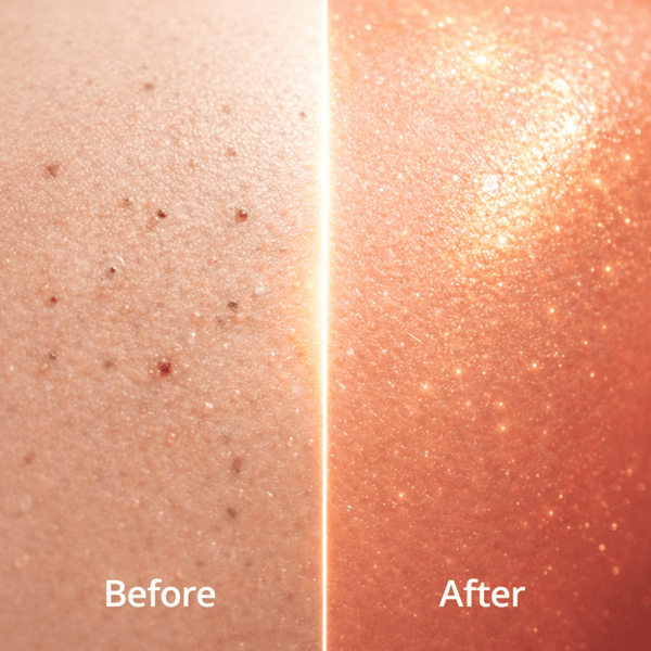 Lifebuoy Total 10 Soap - CosFair GmbH