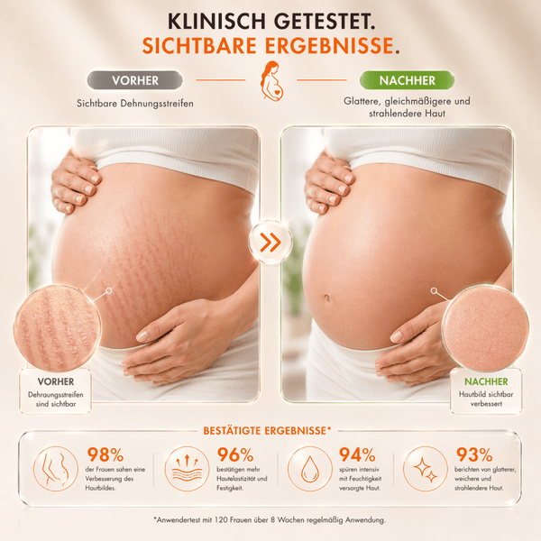 Palmer's Cocoa Butter Massage Cream - Stretch Marks - CosFair GmbH