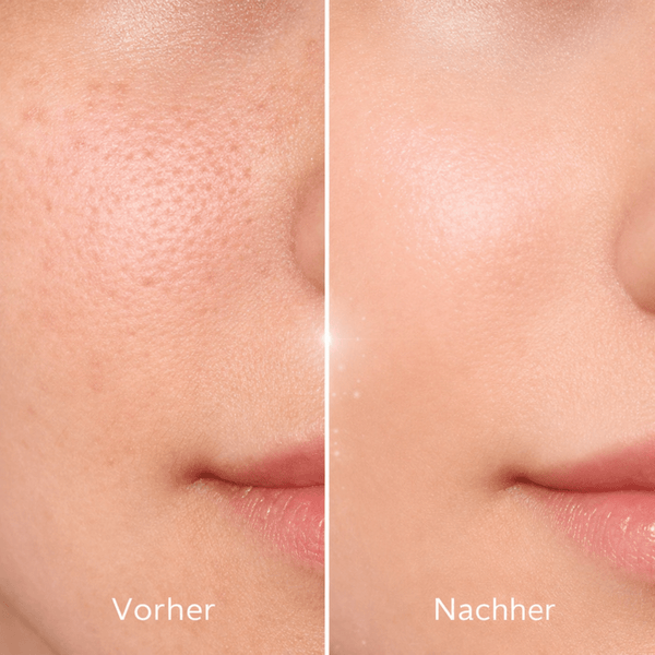 St. Ives Fresh Skin Apricot Scrub 150 ml - CosFair GmbH